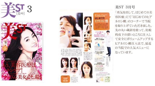 美ST2